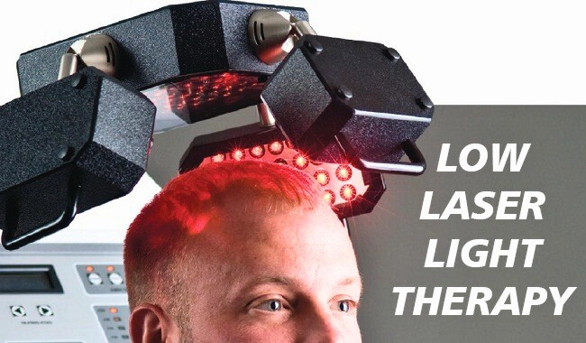 Low-level Laser Therapy (LLLP) for hair loss